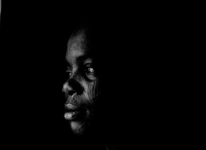 Foto do rosto de uma pessoal preta de perfil cheia de cicatrizes no rosto. A foto ilustra o artigo O tratamento psicanalítico pode apagar completamente as cicatrizes emocionais? escrito pelo psicanalista Homero Mônaco para o site A Sessão de Terapia.